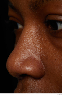 HD Face Skin Dina Moses face nose skin pores skin…